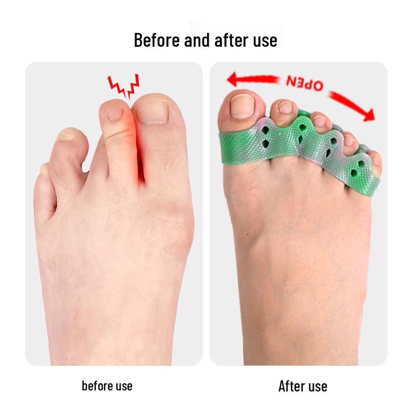 Colorful SEBS Five-Hole Toe Separator for Bunions and Overlapping Toes