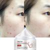 Whitening Essence Cream, Even Facial Skin, Anti-oxidation Anti-aging, Moisturizing Acne Cream
