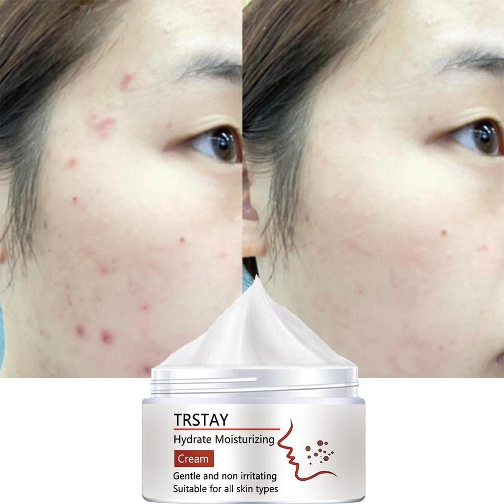 Whitening essence cream, even facial skin, anti-oxidation anti-aging, moisturizing acne cream