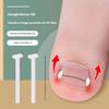 Titaniums Alloy Ingrown Toenail Treatments Ingrown Toenail Removal Kit Ingrown Toenail Corrector,Nail Correction Tools