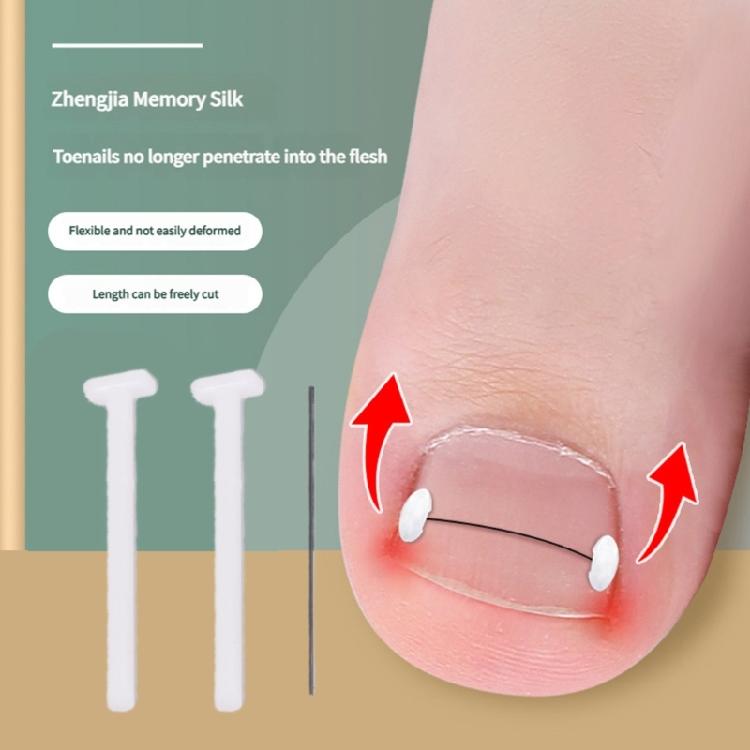 Titaniums Alloy Ingrown Toenail Treatments Ingrown Toenail Removal Kit Ingrown Toenail Corrector,Nail Correction Tools