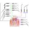 VVDental Ultraschall-Scaler-Spitzen Kompatibel Mit EMS / Woodpecker-UDS Zahnaufhellung Scaling Werkzeuge