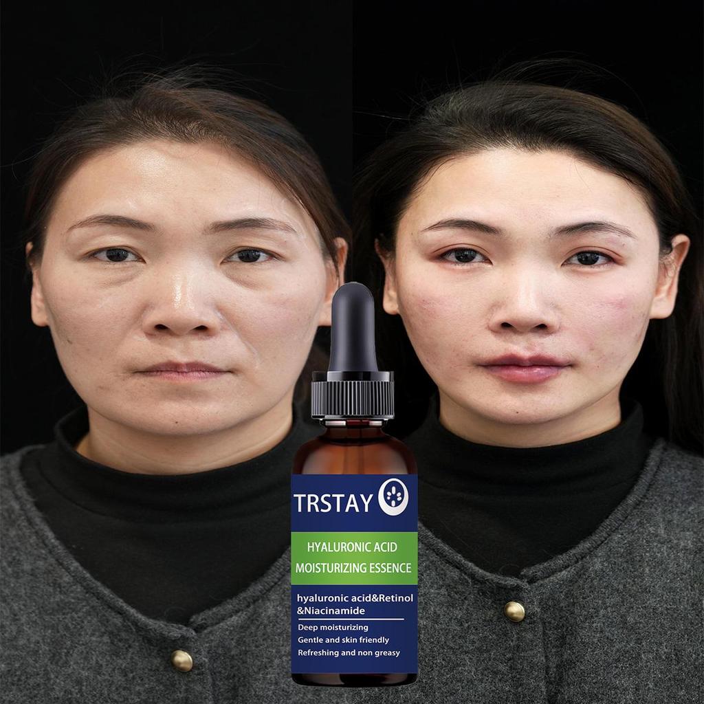 Hydrating And Restoring - Day And Night Face Cream Containing Retinol And Hyaluronic Acid Can Promote Skin Renewal And Reduce Wrinkles And Fine Lines