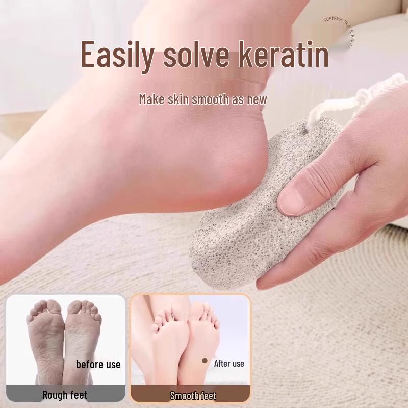 Foot Callus Remover 2-Piece Set