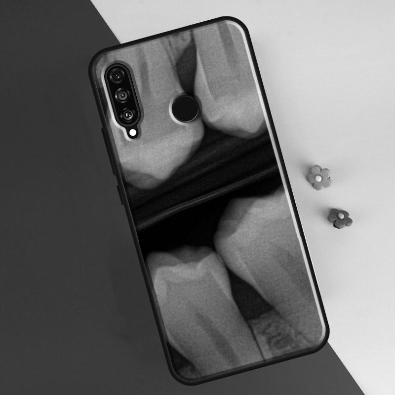 Husă cu Model Dinte de Dentist Pentru Huawei P30 Pro P50 P20 P40 Lite P Smart 2021 Nova 5T Huse Pentru Honor 50 8X 10i