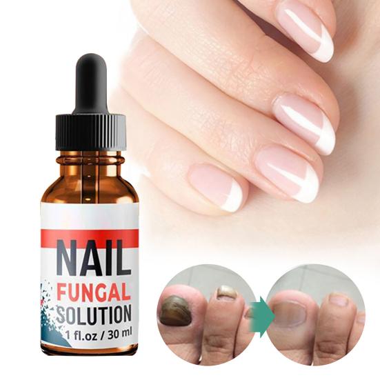 10ml/20ml/30ml Anti Fungus Liquid Toe Finger Nail Infection Repair Treatment