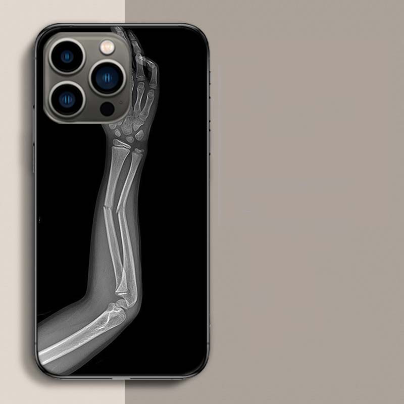 Herbst Röntgen Handknochen Handyhülle Für Apple Iphone 16E 16 17 Pro Max Air 15 Pro 14 Plus 12 13 Mini Hülle Niedliche Fundas Silico