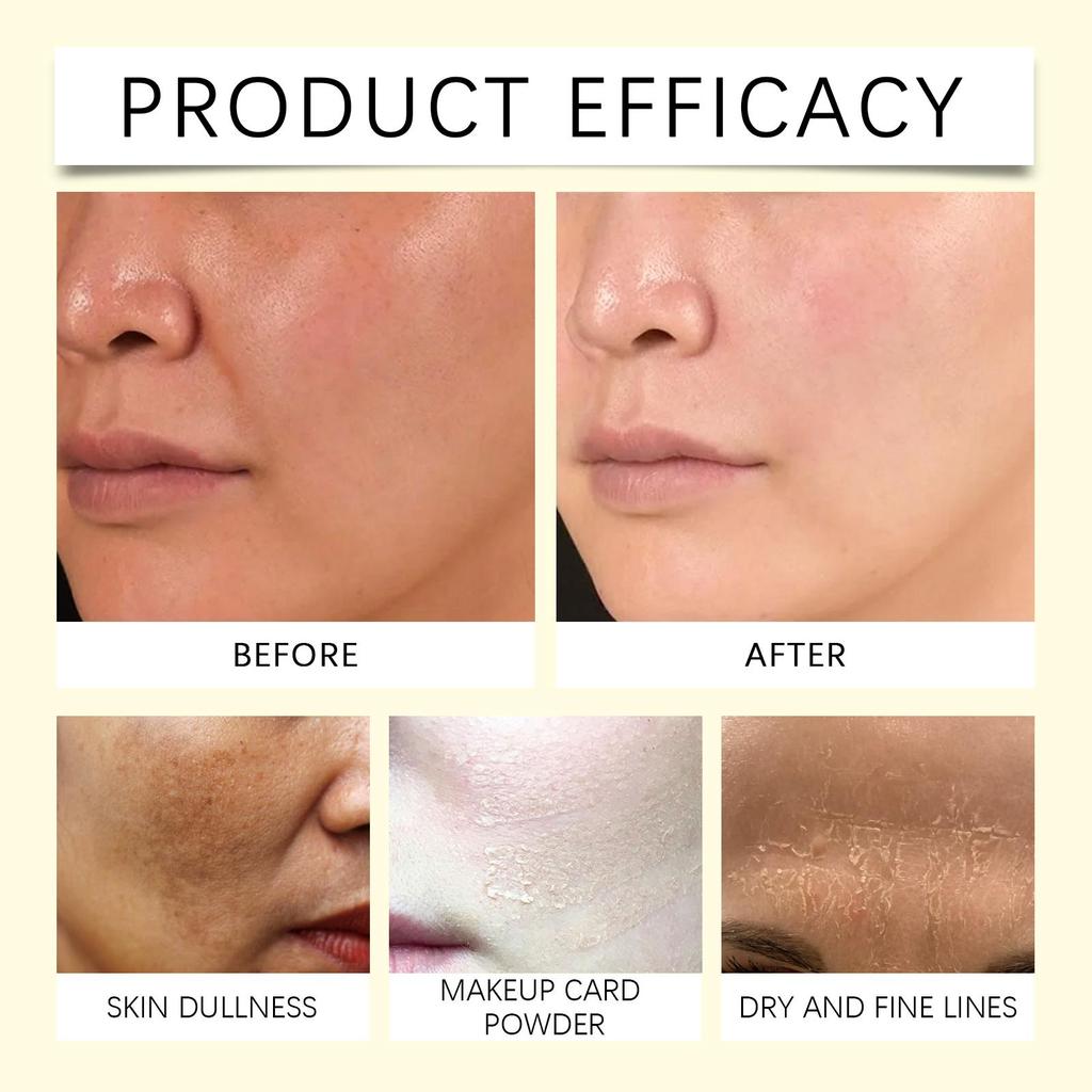 Niacinamide Face Serum Dark Spots Removal Brightening Rejuvenating Fade Melasma Hydrating Anti Wrinkle Vitamin B3 Essence