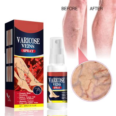 Spray per vene varicose, Spray per vene varicose, Spray per vene varicose 30ml