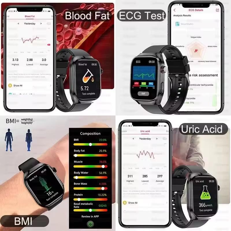 2025 New Blood Lipid Uric Acid Treatment Smart Watch Men ECG+PPG Heart Rate Sports HD Call Health Track for Samsung Smartwatch