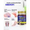 Chinese Varicose Vein Gel for Legs
