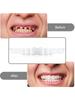 2 Pairs Dentures Teeth Protect Your Teeth Temporary Teeth Regain Confident Smile Upper False Tooth Cover Snap for Men and Women