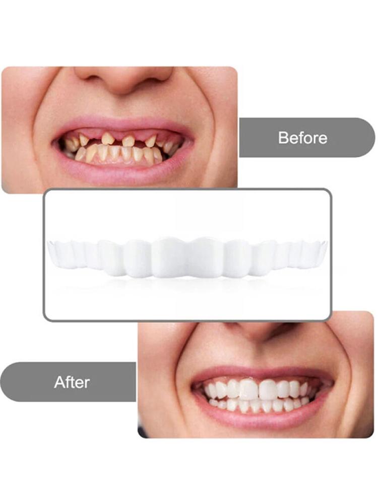 2 Pairs Dentures Teeth Protect Your Teeth Temporary Teeth Regain Confident Smile Upper False Tooth Cover Snap for Men and Women