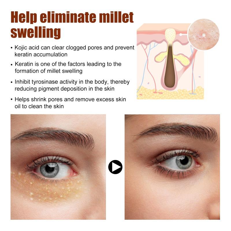 Reparação de inchaço de castanha, grãos de gordura para clarear as linhas finas dos olhos, creme nutritivo para os olhos, clareamento de rugas, creme para os olhos tensor