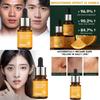 Premium Vitamin C Essence 30ml Hydrating Brightening Skin Serum For All Skin Types