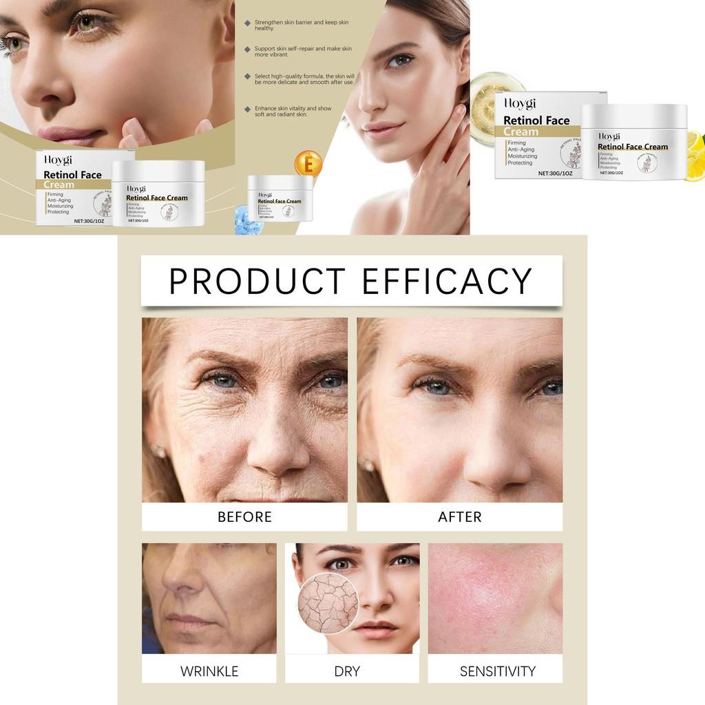 Hoygi Retinol Moisturizing Cream With Brightening And Hydrating Collagen Formula