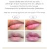 NEEDLY - Tint Lip Balm