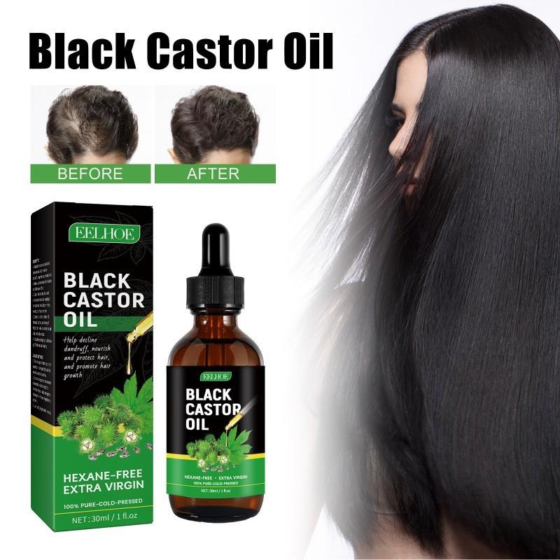 Eelhoe Castor Oil Hair Growth Serum Nourishing And Strengthening 30ml For Thicker Hair
