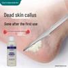 Foot Sole Keratin Softener: Callus & Dead Skin Remover, Moisturizes Cracked Feet