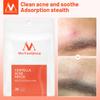 Centella Acne Patch Stickers Лікування прищів Інструмент для видалення прищів Маска для обличчя Догляд за шкірою Водостійкий 24 патчі