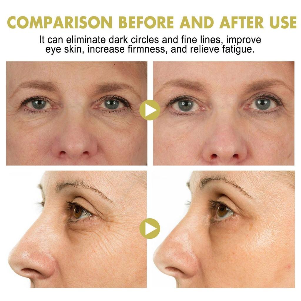 Jaysuing Snail Eye Cream Stick For Diminishing Fine Lines And Dark Circles 3g