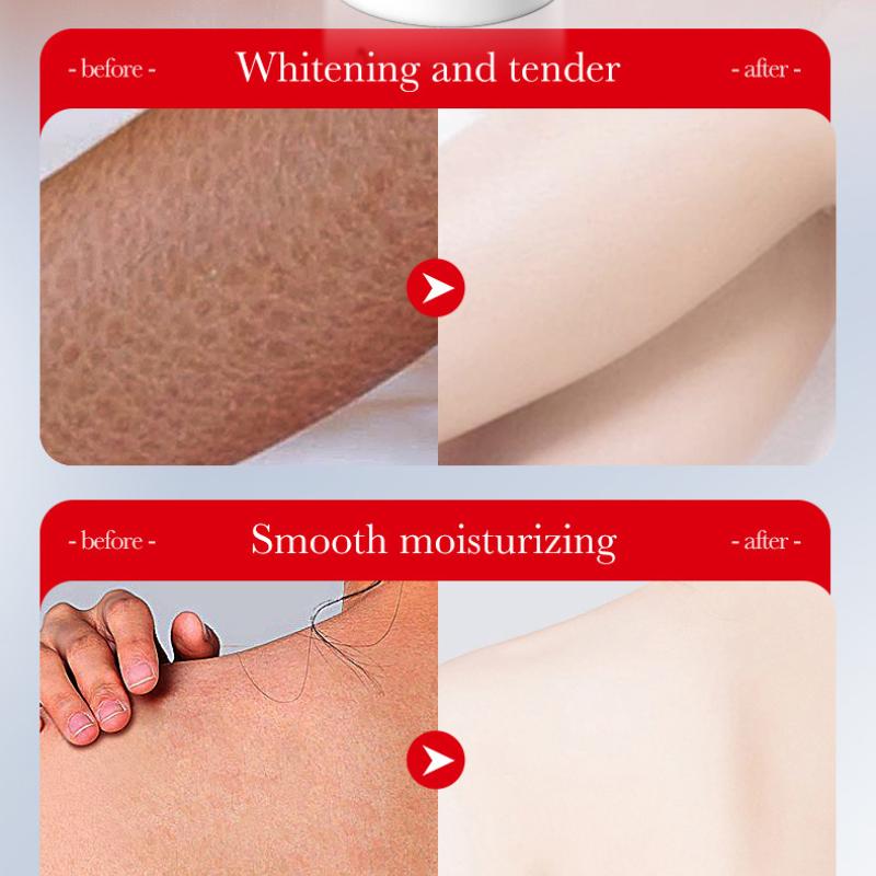 Kojicsyre Whitening Body Lotion 250gSADOER Fuktighetsgivende Oppstrammende Foryngende Body Lotion