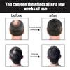 Essence pour cheveux épais pour hommes Solution de soin pour cheveux épais et solides, nutritive, hydratante, anti-chute