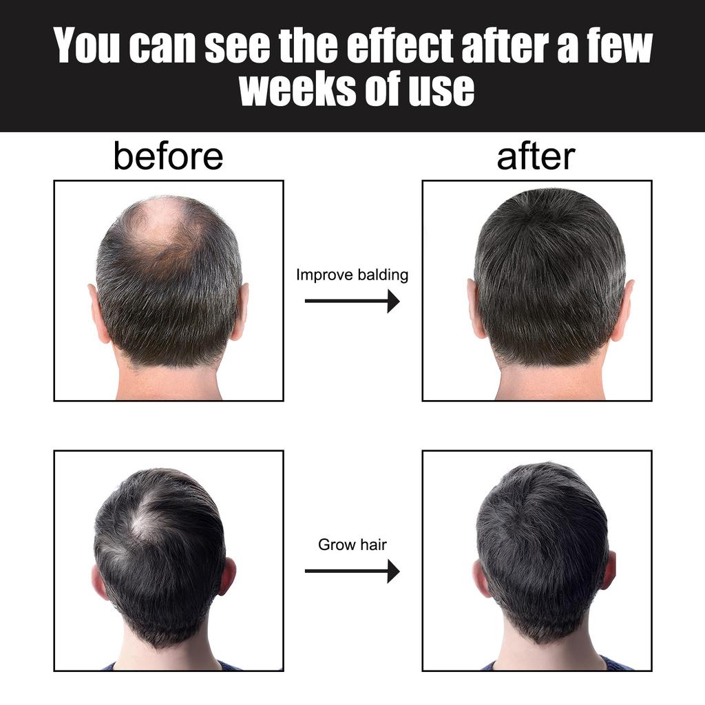 Essence pour cheveux épais pour hommes Solution de soin pour cheveux épais et solides, nutritive, hydratante, anti-chute