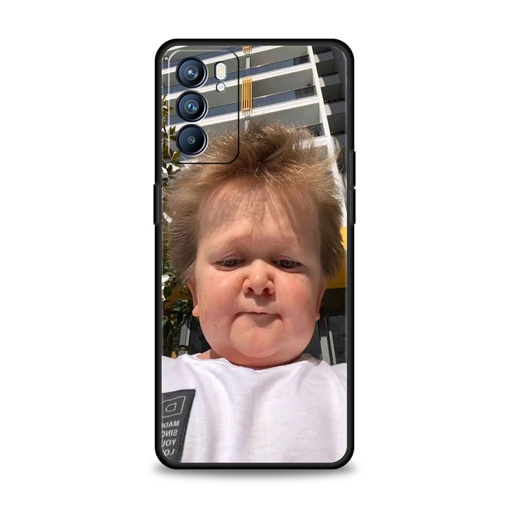Funny Hasbulla Phone Case For Oppo Reno8 Reno7 Reno6 Pro A54 5G Find X6 X5 A53 A52 A9 A15 A95 A17 A16 A76 A74 A57 A31 Cover