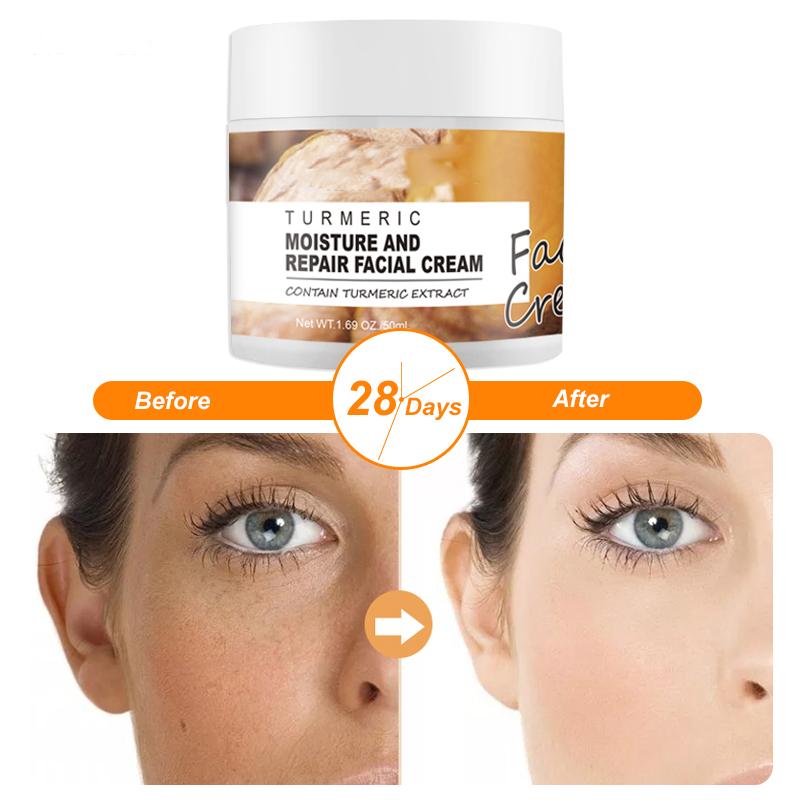 Turmeric Facial Skin Repair Cream Acne Treatment Face Moisturizer Whitening Lightening Against Acne Remover Cream