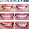 SP-6 Probiotic Whitening Toothpaste, Sp-6 Ultra Whitening Toothpaste for Teeth Whitening, Fresh Breath and Gum Health, Fluoride-Free Fresh Mint Flavor