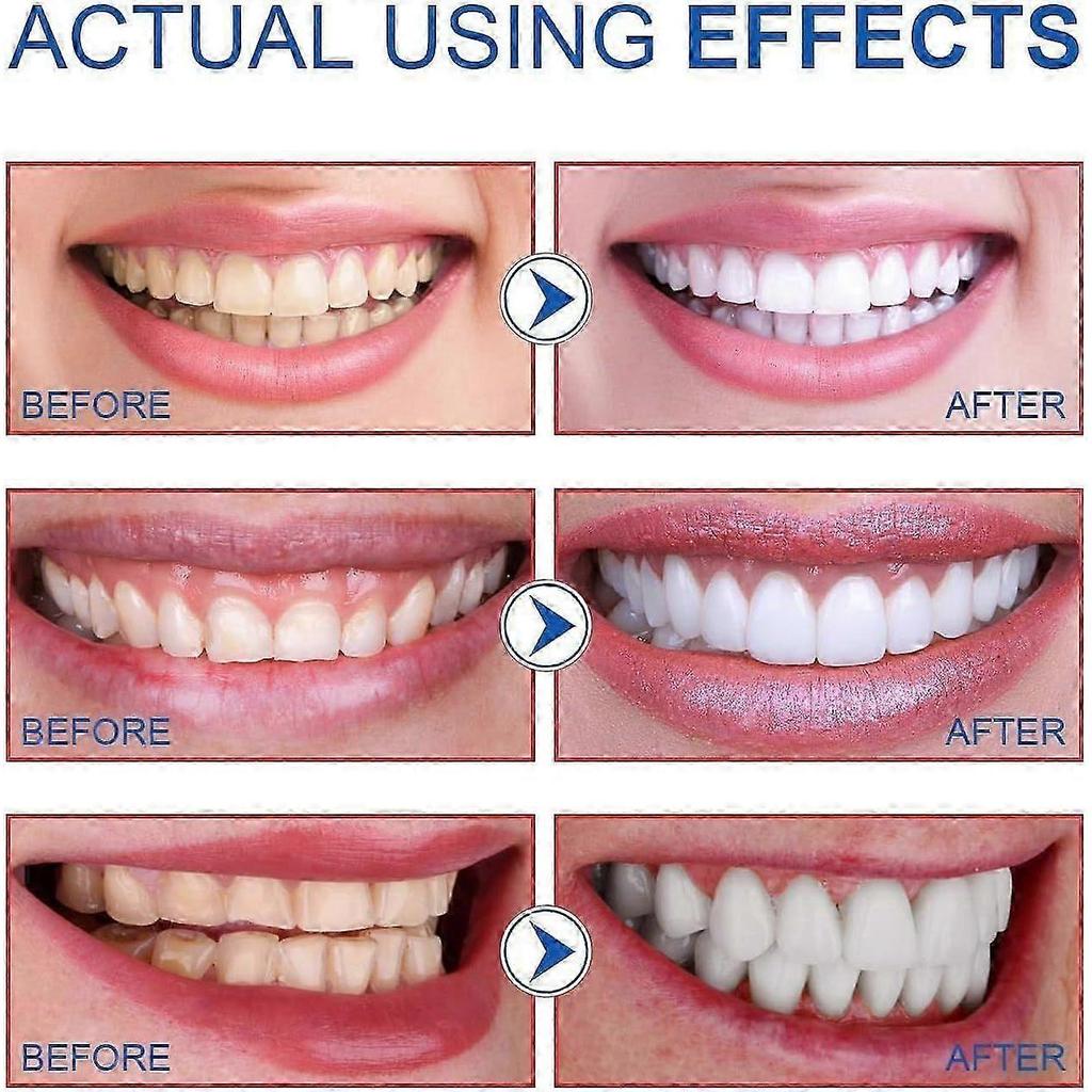 SP-6 Probiotic Whitening Toothpaste, Sp-6 Ultra Whitening Toothpaste for Teeth Whitening, Fresh Breath and Gum Health, Fluoride-Free Fresh Mint Flavor