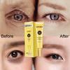 Eye Cream Skin Care Eye Essence Whitening Anti Aging Anti Wrinkle Remove Dark Circles Eye Creams