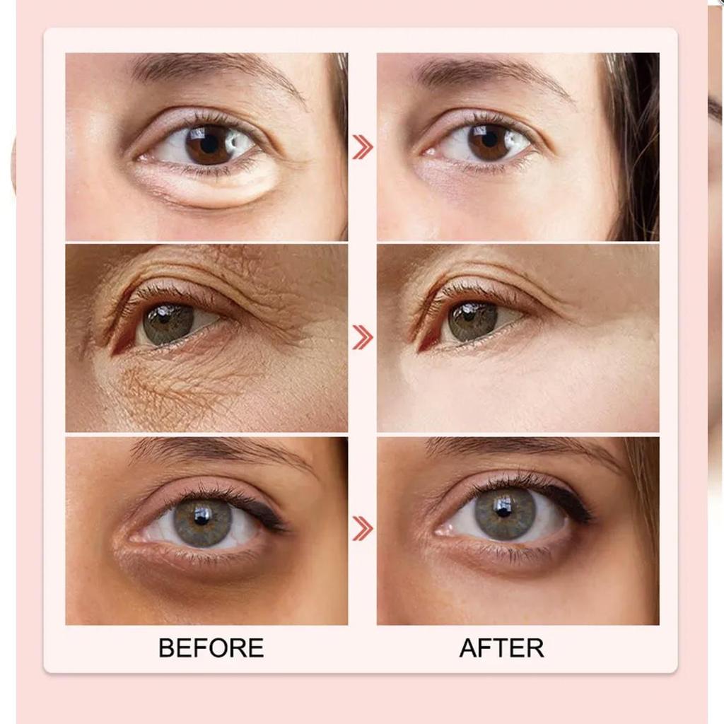 Eye Cream Adrenaline Strengthens and Cares for the Skin Around the Eyes, Whitening and Brightening the Skin, Hydrating and Moisturizing Eye Cream