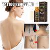 Tattoo-Reinigungslösung zur schnellen Entfernung von Tattoo-Farbe und semipermanenten Pigmenten, 30 ml