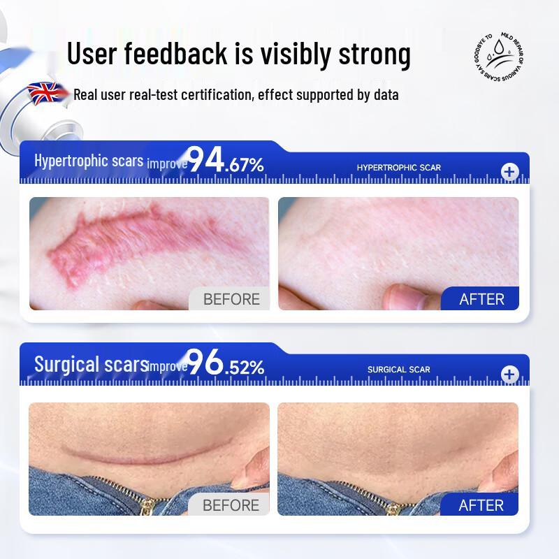 Advanced Scar Repair Treatment Gel