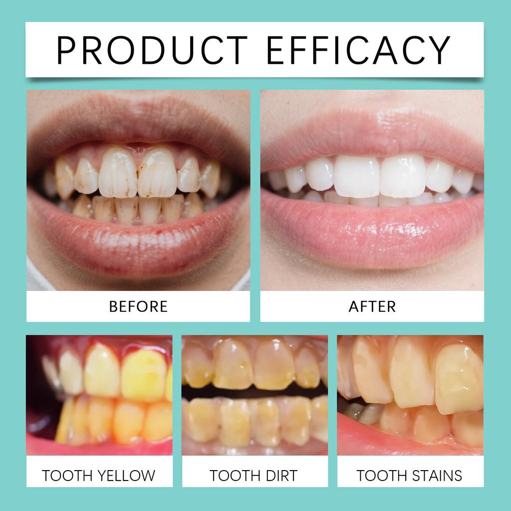 The Teeth Refreshing Set Is A Daily Post-meal Cleaning, Brightening And Refreshing Care Product For The Gaps Between Teeth,20ML