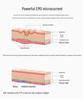 Popular Photon Rejuvenating Mask: EMS Radio Frequency Face Lifting, Firming, and Light Therapy Device