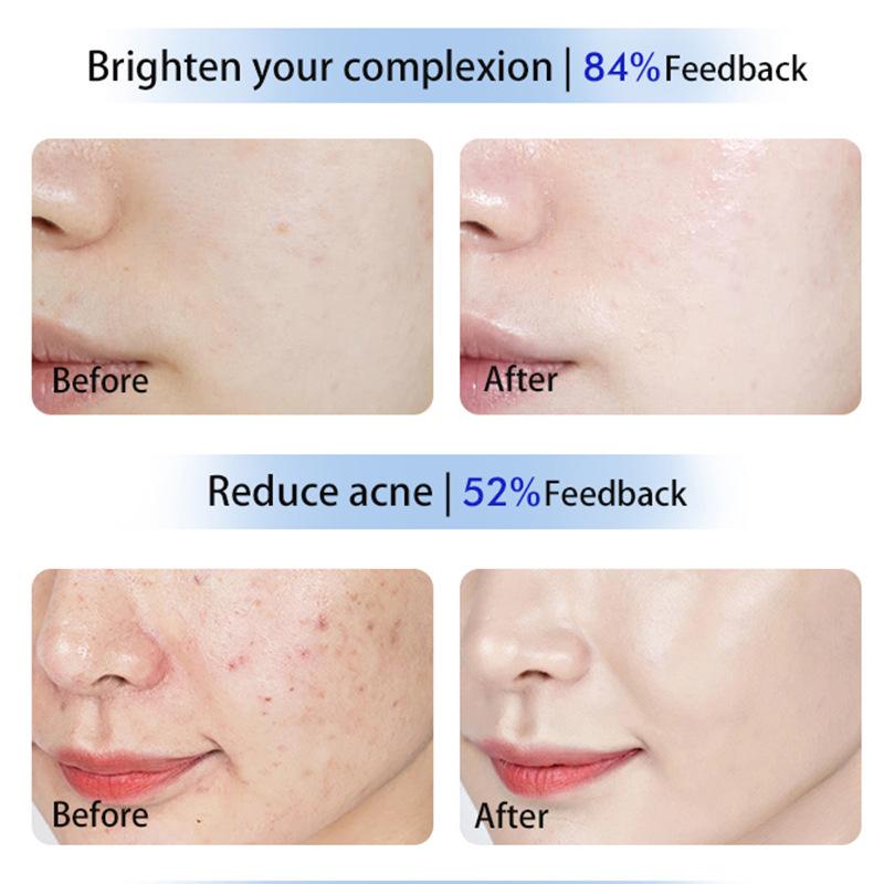 Big Row Lamp Beauty Instrument Facial Photon Skin Care Skin Rejuvenation Red and Blue Spectrum Mask Spectrometer Available All Over The Body