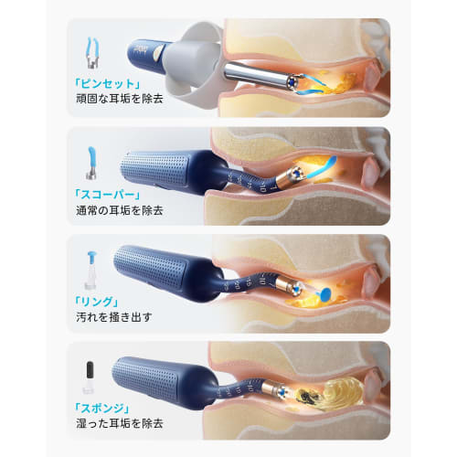 BEBIRD R37R Earpick with Camera, Ear Cleaning Camera, Includes 3.1mm Ultra-Fine Lens, 10 Million Resolution, and Storage Case, Earscope, High-Precisio