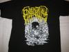 Epicardiectomy Band Tour Geschenk Für Fan Alle Größen S bis 5XL Unisex T-Shirt MD131 Unisex T-Shirt