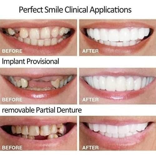 Two Pairs of Dentures, Temporary Teeth, Smile Now with Comfortable Elastic Teeth - Matching Upper and Lower Sets, Instant Dentures for Men and Women,