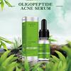 Oligopeptide Acne Clearing Serum Treatment Cream Pore Repair Anti Aging Moisturizing Essence