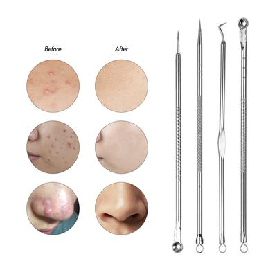 Blackhead Remover Pimple Popper Tool Kit for Pimple Blemish Comedone   Zit    Face Chin Noze For  Cheek Body