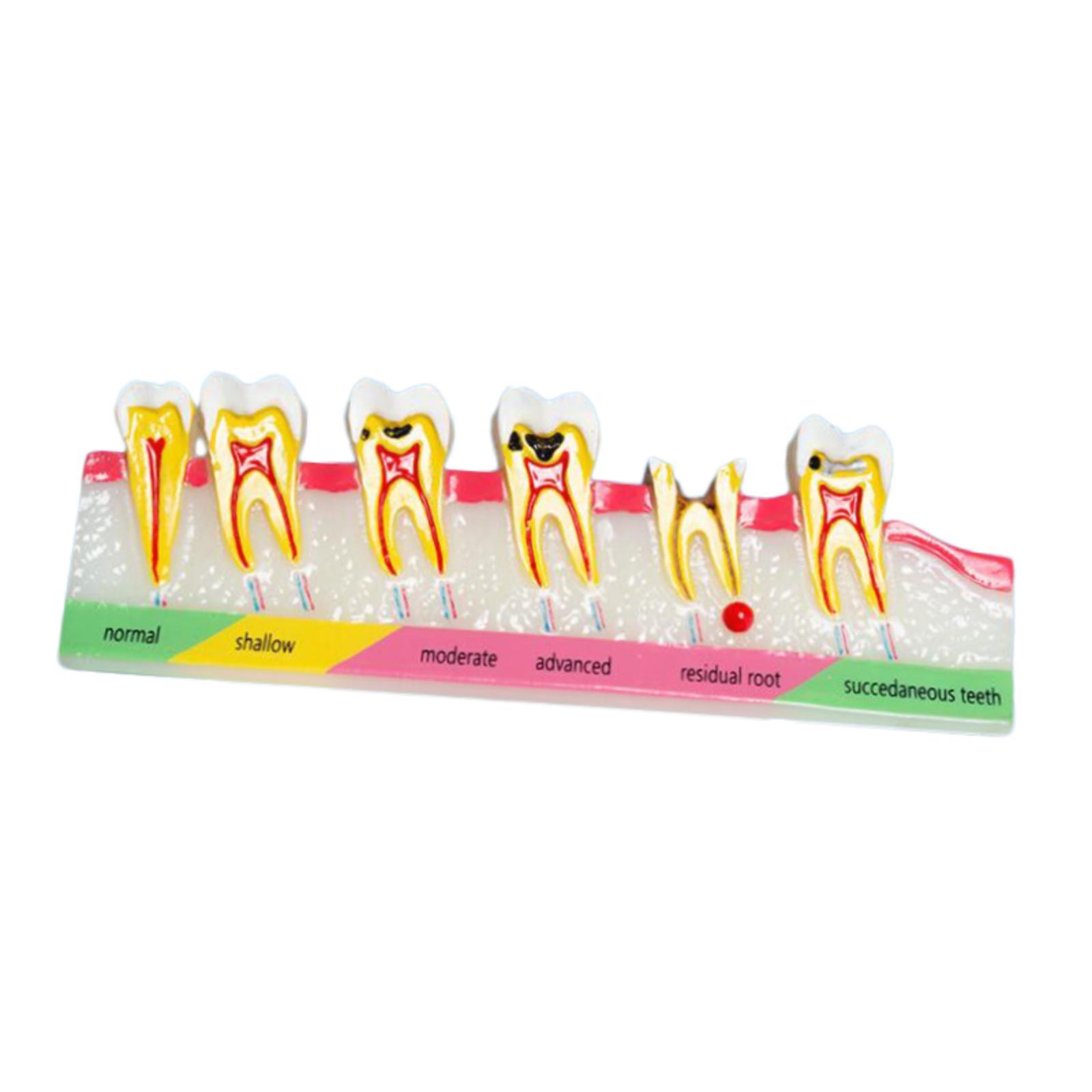 

Demonstration Tooth Model Soft Education Clean Display Removable Dental Model Dental Teaching Teaching Tool Standard Tooth