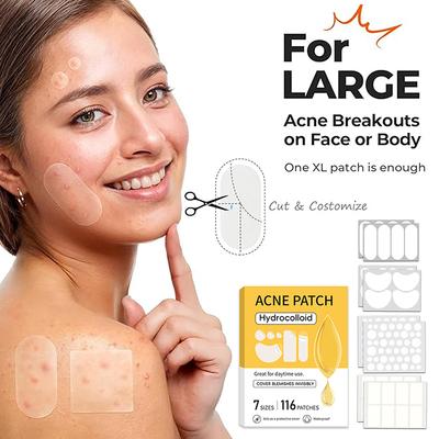 Trattamenti viso – Rimedi contro l'acne