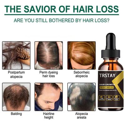 Ginger Oil, Natural Plant Essence, Hair Care for Scalp, Hair Loss Prevention, Essence Oil, Hair Loss Free, Hair Care and Beauty Tool
