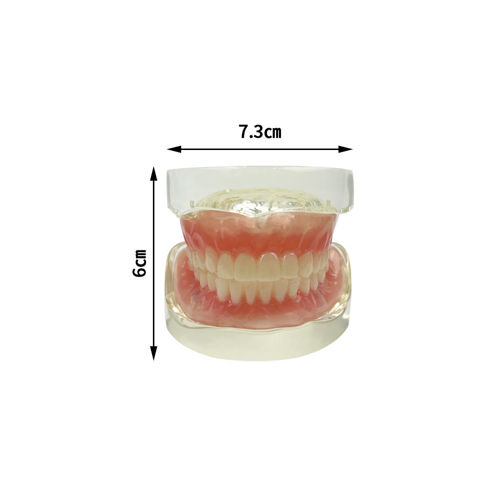 Modelo de Implante Dental 2 Implante Prótesis Completa Superior Inferior Modelo de Dientes Typodont Productos de Odontología Para Enseñanza Estudio