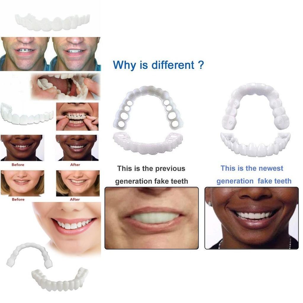 On Fake Snap Teeth Upper Lower Dental Veneers Denture Tooth Cover Simulation Set Cosmetic Braces