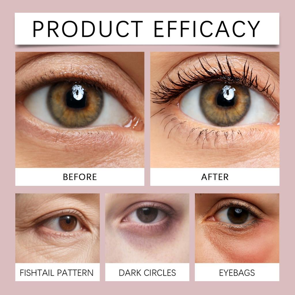 Viareline softening Eye Care Cream gently moisturizes the skin around the eyes, a daily basic eye care product 30g